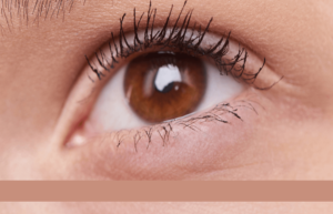 Upper Eyelid Lift